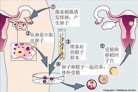 生殖科主任